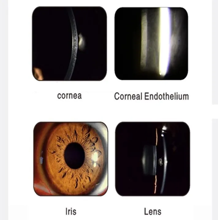 Best Digital Slit Lamp Price with HD SRL Camera Slm-3er and Free Software