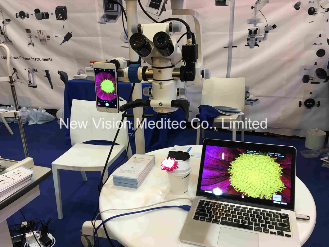 FHD Video Camera for Digitalizing Surgical Operation Microscope