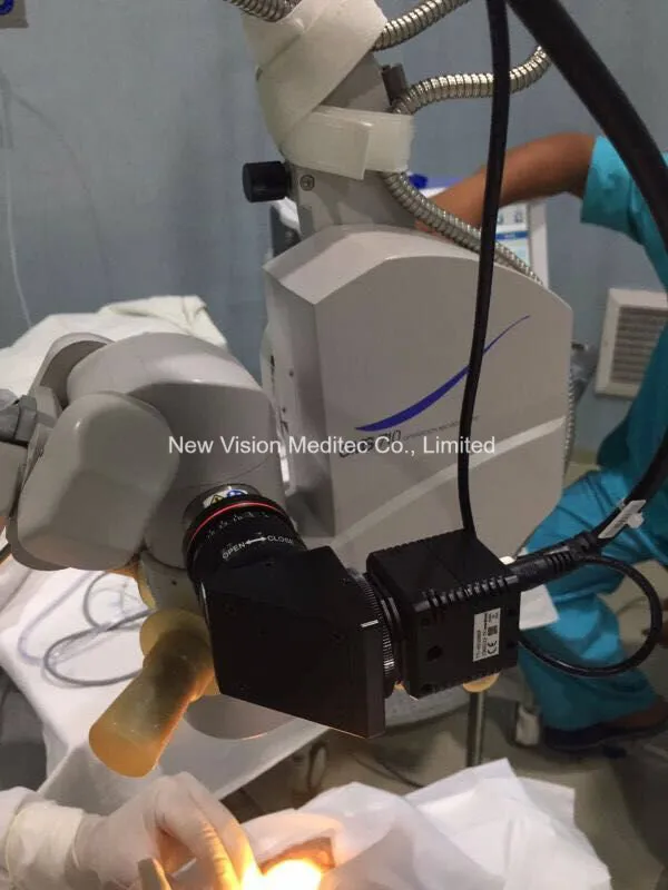 FHD Video Camera for Digitalizing Surgical Operation Microscope