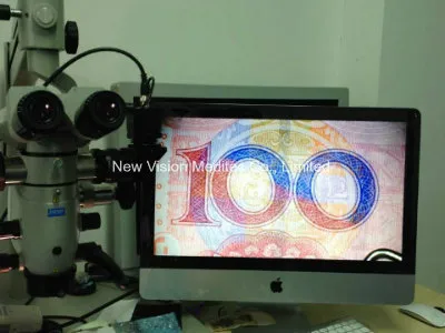 FHD Video Camera for Digitalizing Surgical Operation Microscope